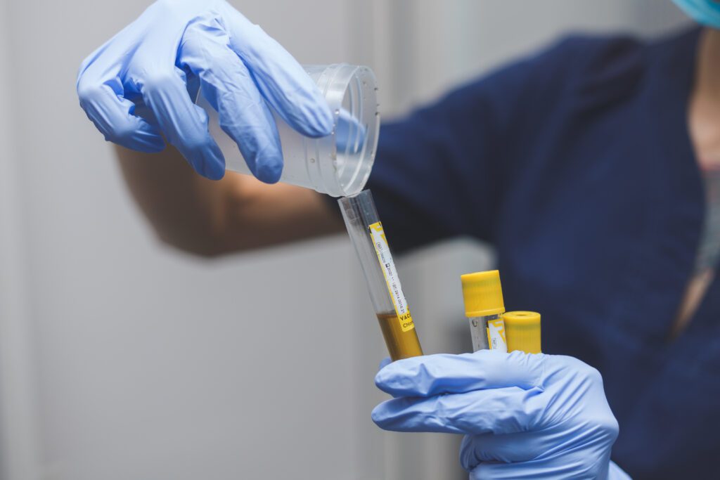 Responsável fazendo a distruição da coleta de urina para realização do exame de rotina de um paciente